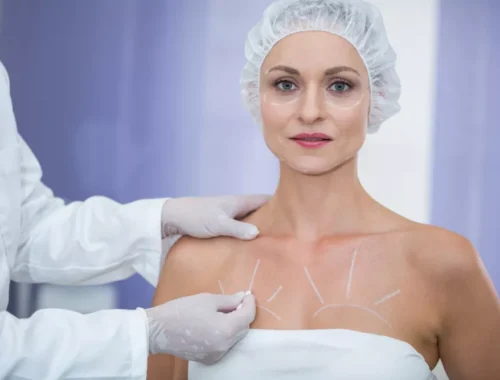breast-lift-69d0ae6f6aef4