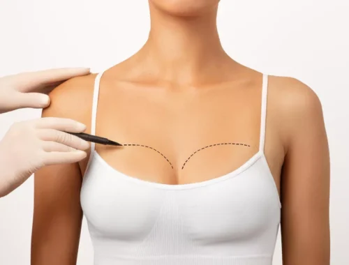 breast-surgery-69d0ae6fdbf09