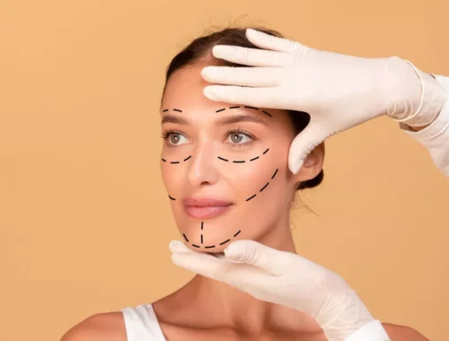 facelift-surgery-69d0ae7971d6e