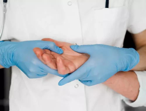 hand-surgery-69d0ae7b692d0