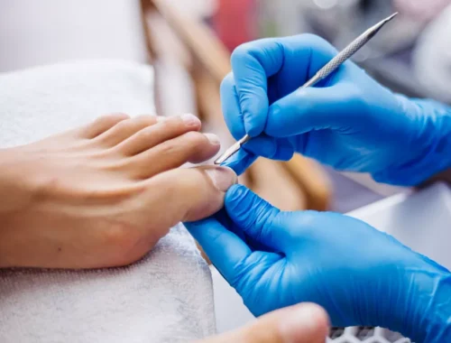 ingrown-toenail-treatment-69d0ae8a42e74