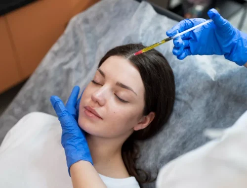 platelet-rich-plasma-therapy-69d0ae8a4a41e