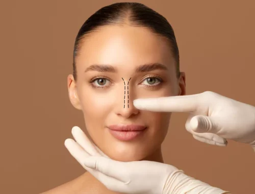 septoplasty-69d0ae965eeef