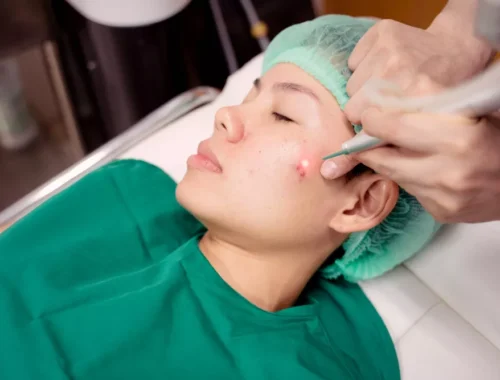 skin-plastic-surgery-69d0ae93ac513