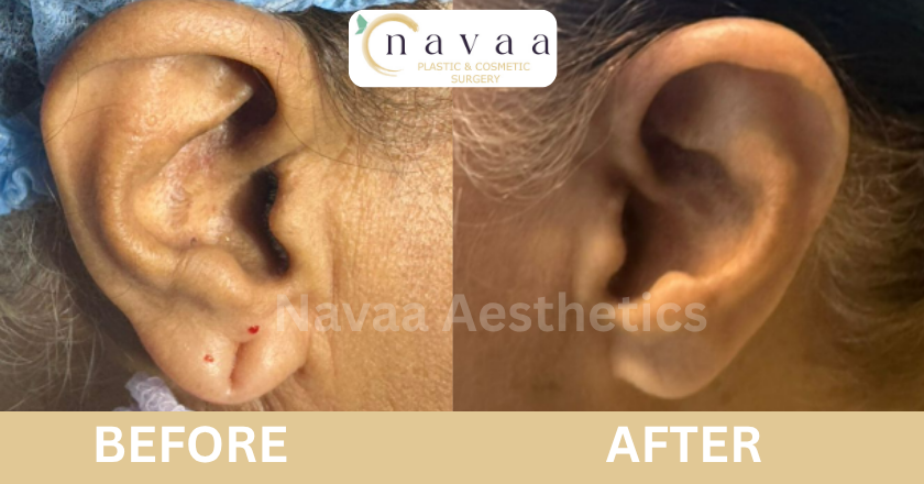ear hole stitching