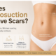 Liposuction scars and small incision marks after cosmetic surgery
