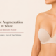 Breast implants after 10 years showing long-term monitoring and implant health