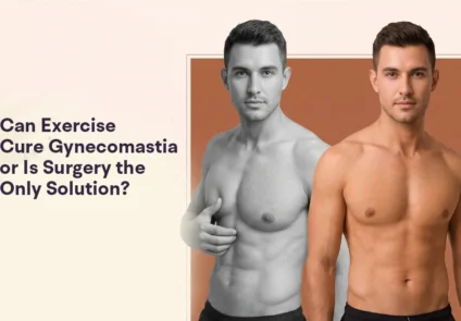 how to get rid of gynecomastia