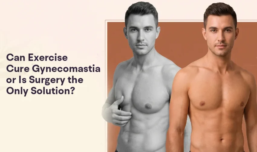 how to get rid of gynecomastia