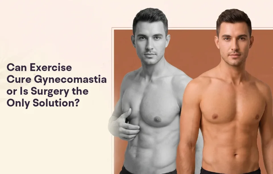 how to get rid of gynecomastia