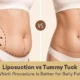 liposuction vs tummy tuck
