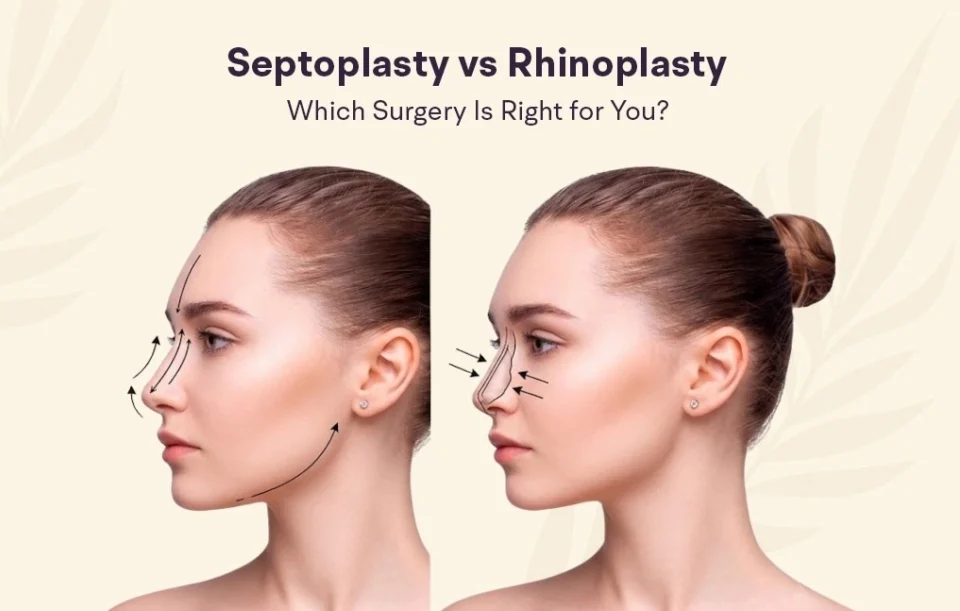 septoplasty-in-mumbai
