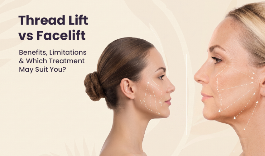 thread lift treatment thread lift treatment