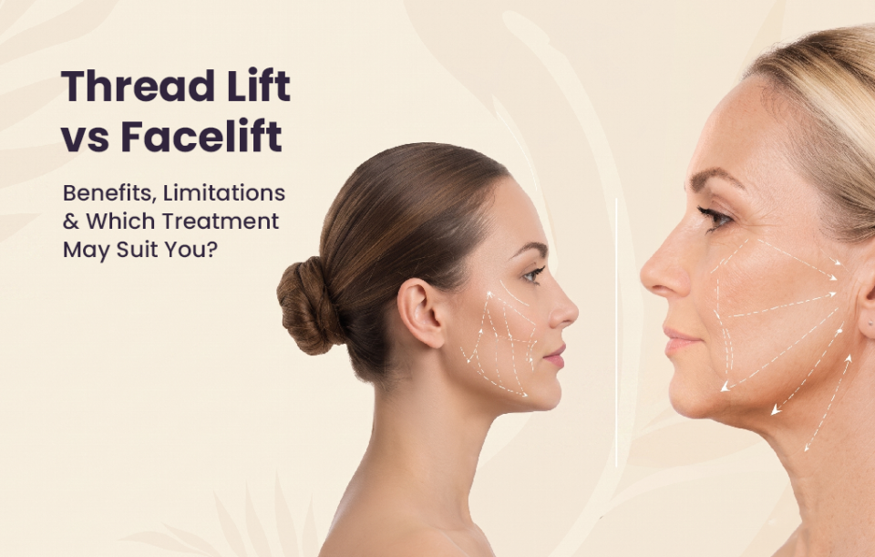thread lift treatment